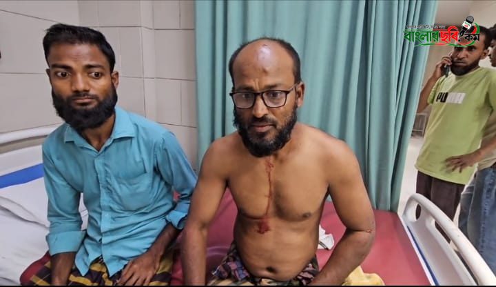 সাভারে ফিলিং স্টেশনে ট্রাকের সিলিন্ডার বিস্ফোরণে আহত ৩